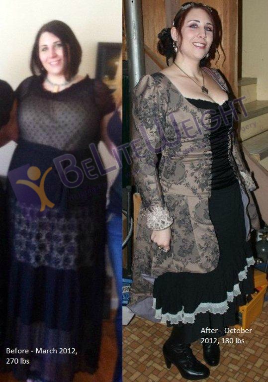 Leslie - Before and After Gastric Sleeve Surgery Photos | BeLiteWeight | Weight Loss Services