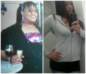 Before and After Gastric Bypass Photos & Story | BeLiteWeight | Weight Loss Services