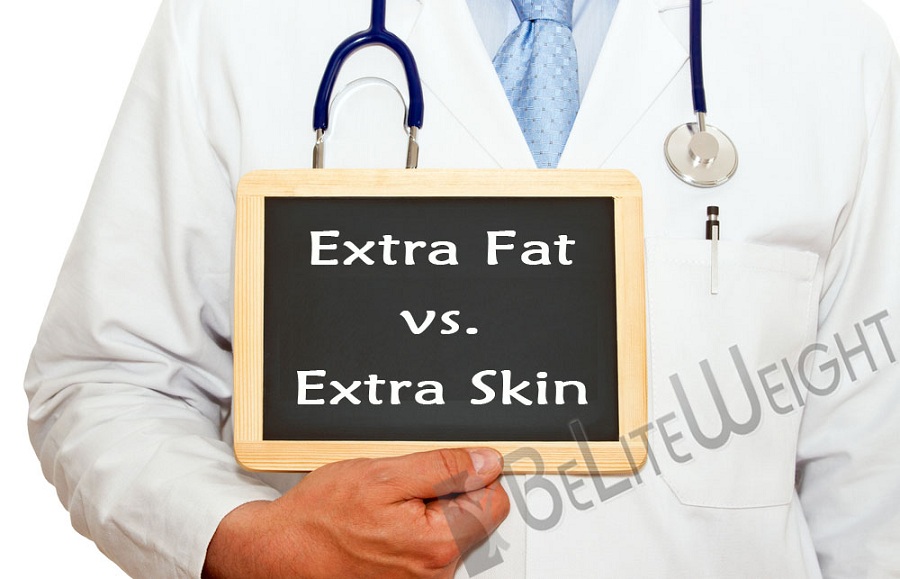 Extra Fat VS Extra Skin|BeLite Weight|Weight Loss Services
