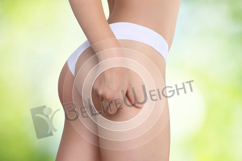 Lighten Up Your Cellulite|BeLite Weight|Weight Loss Services