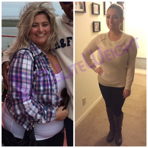 karina s 6 month after weight loss surgery gastric sleeve vsg