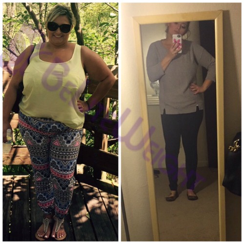 karina s 4 month after weight loss surgery gastric sleeve vsg