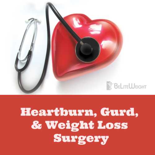 heartburn gurd weight loss surgery before and after vsg sleeve keto