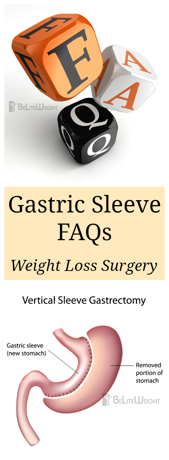 Gastric Sleeve FAQs - Vertical Sleeve Gastrectomy FAQs