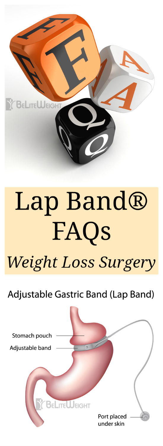 Lap Band FAQs - Gastric Band FAQs