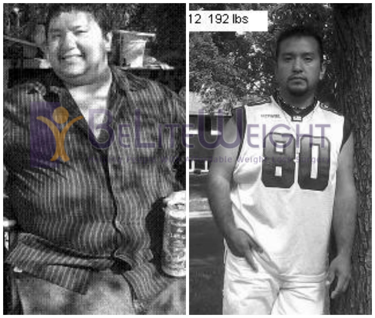 Ramon's Amazing Weight Loss Surgery Before and After Photos