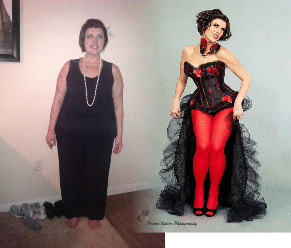 My Lifelong Struggle with Obesity and Weight Loss