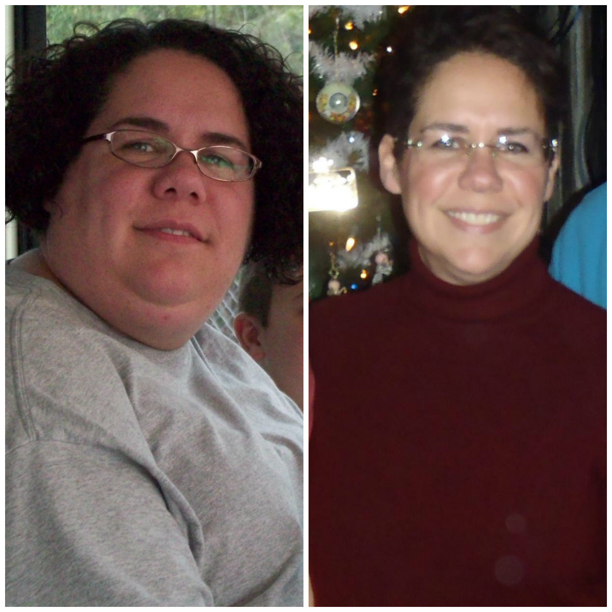 Marlee's Before and After Gastric Sleeve Surgery Photos & Story