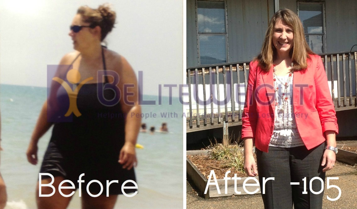 Tracy's Amazing 105 Pound Weight Loss Story and Photos | BeLiteWeight | Weight Loss Services