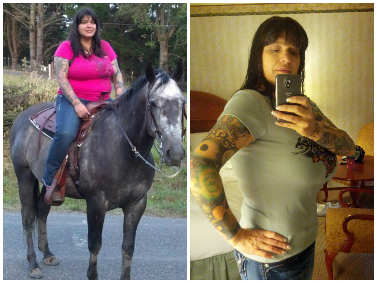 Kristy Before and After Weight Loss Surgery | BeLiteWeight