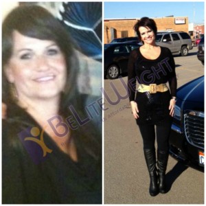 Gastric Bypass Surgery helped Jan lose 126 pounds in 8 months! Doesn't she look wonderful? | BeLiteWeight.com