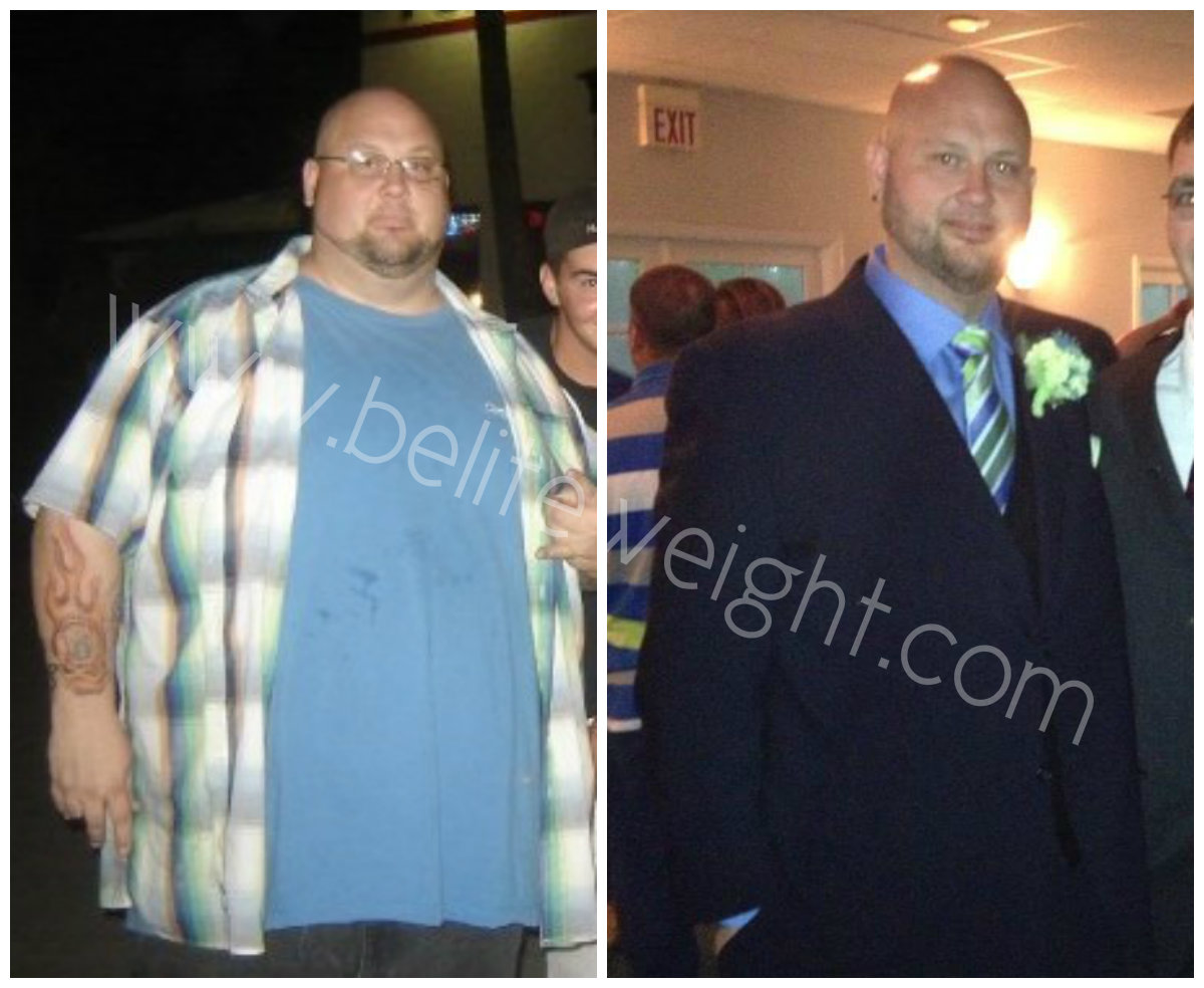 Brian's Long Term Before and After Gastric Sleeve Success Story & Photos