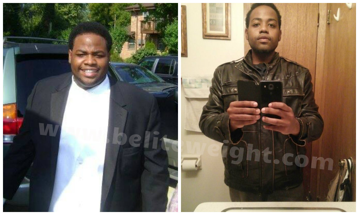 Long Term Weight Loss Success – Markel’s Lap Band Journey
