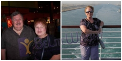 gastric sleeve before and after weight loss surgery