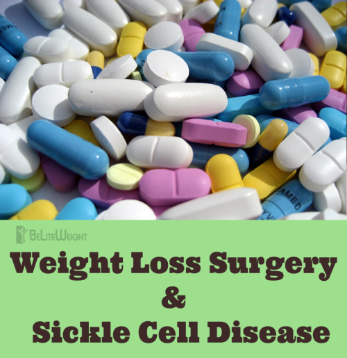 weight loss surgery benefits health ebfore after wls gastric bypass sleeve