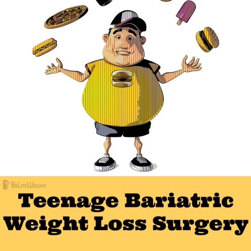 weight loss surgery before after vsg gastiric sleeve teenage bariatric surgery
