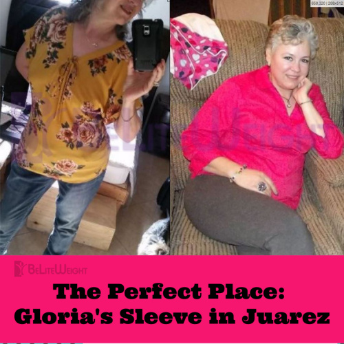 gloria before after juarez gastric sleeve weight loss surgery bariatric vsg