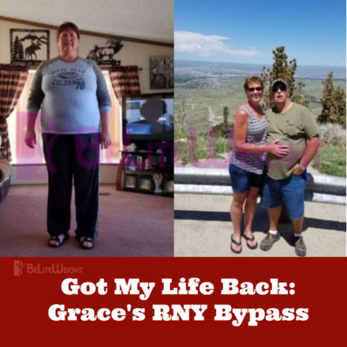 weight loss surgery before and after dionne gastric sleeve