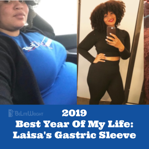 weight loss surgery before and after vsg