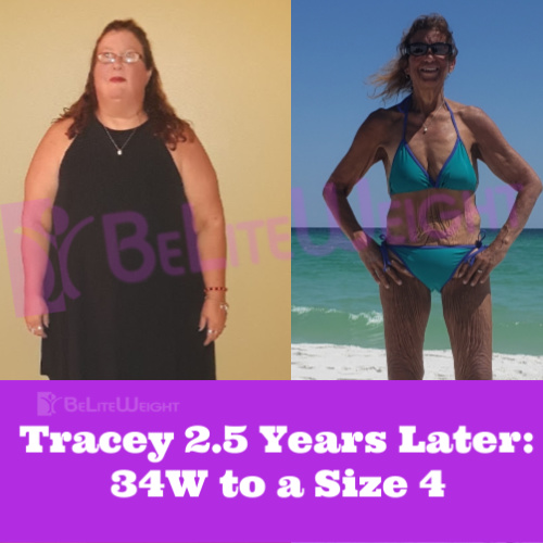 Tracey T Weight Loss Surgery Before and After