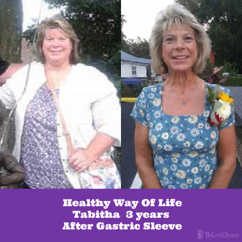 Healthy Way Of Life Tabitha 3 years After Gastric Sleeve