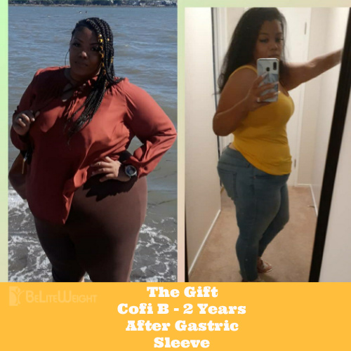 The Gift Cofi B - 2 Years After Gastric Sleeve - BeLiteWeight