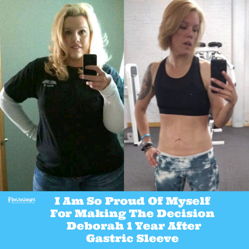 I Am So Proud Of Myself For Making The Decision - Deborah 1 Year After Gastric Sleeve