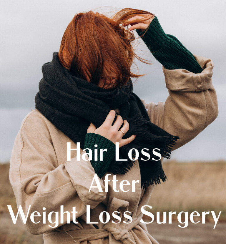 Hair Loss After Weight Loss Surgery BeLiteWeight Weight Loss Services