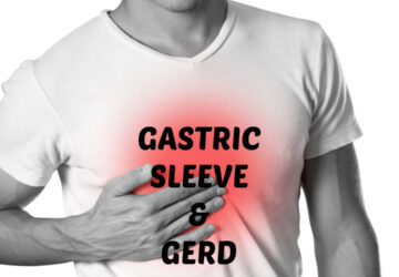 Gastric Sleeve And GERD