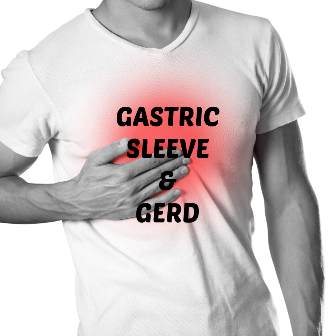 Gastric Sleeve And GERD