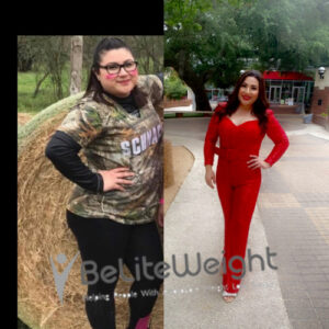Delissa H= Gastric Sleeve Before And After