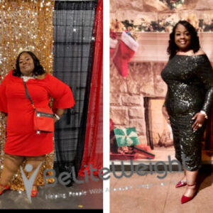 Kemi L= Gastric Sleeve Before And After
