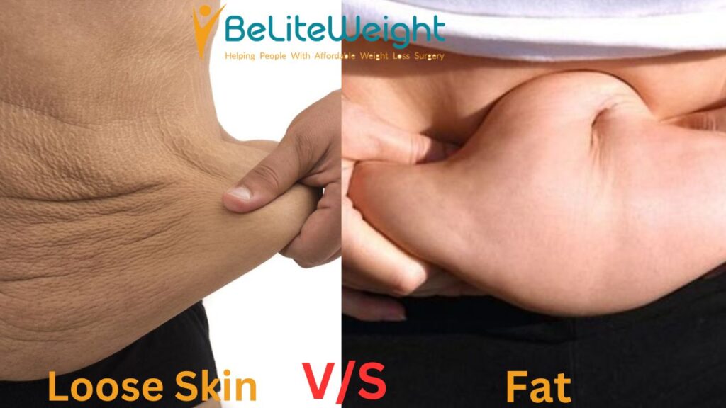 Loose Skin vs Fat