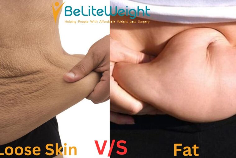 Loose Skin vs Fat