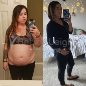 Amanda G = Gastric Sleeve Before And After