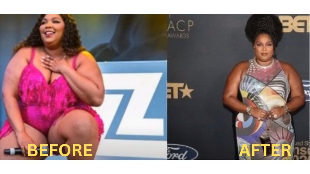 Lizzo Weight Loss Before and After Photos 