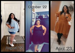 Daisy E= Gastric Sleeve Surgery Before And After