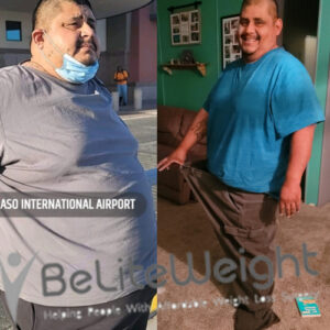 Eriberto Z= Gastric Sleeve Before And After 6 Months