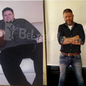 Heath G= Gastric Sleeve Before And After Male