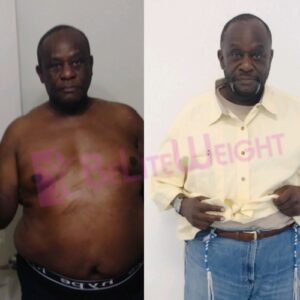 Jaja N= Gastric Sleeve Before And After Male