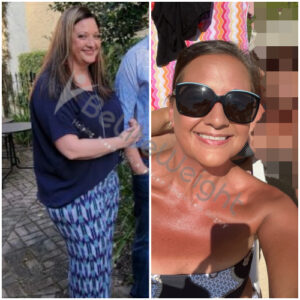 Jennifer L= Gastric Sleeve Before And After Pictures