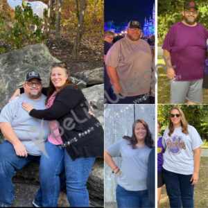 Joseph and Brittany B= Gastric Sleeve Surgery Before And After