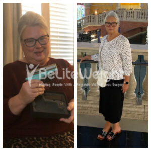 Kathy D= Gastric Sleeve Before And After