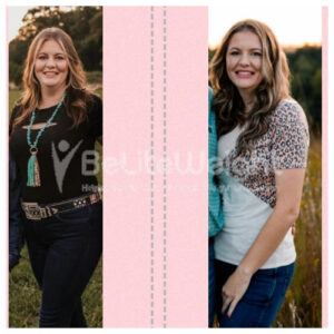 Kayla M= Gastric Sleeve Before And After