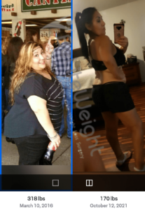 Lynn J= Gastric Sleeve Weight Loss Before And After