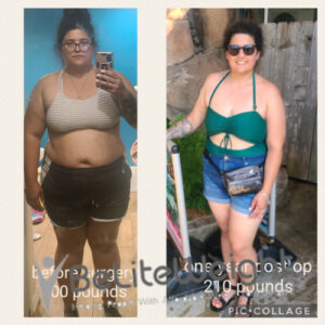 Maeghan M= Gastric Sleeve Before And After Pictures