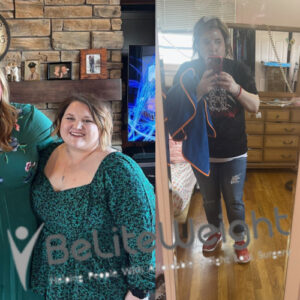 Maggie L= Gastric Sleeve Before And After Pictures