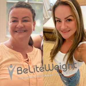 Morgana E= Gastric Sleeve Before And After 6 Months