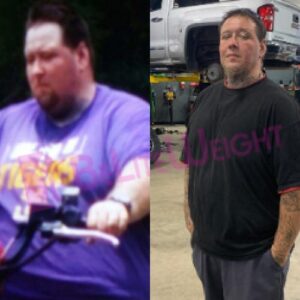 Michael B= Gastric Sleeve Before And After Male