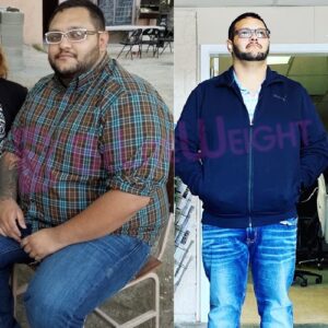 Mike R= Gastric Sleeve Before And After Male